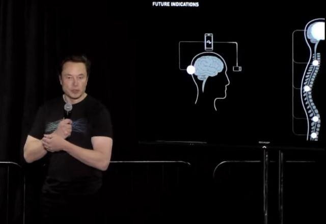 Imagem da noticia Elon Musk quer implantar chips em cérebros humanos em 2023