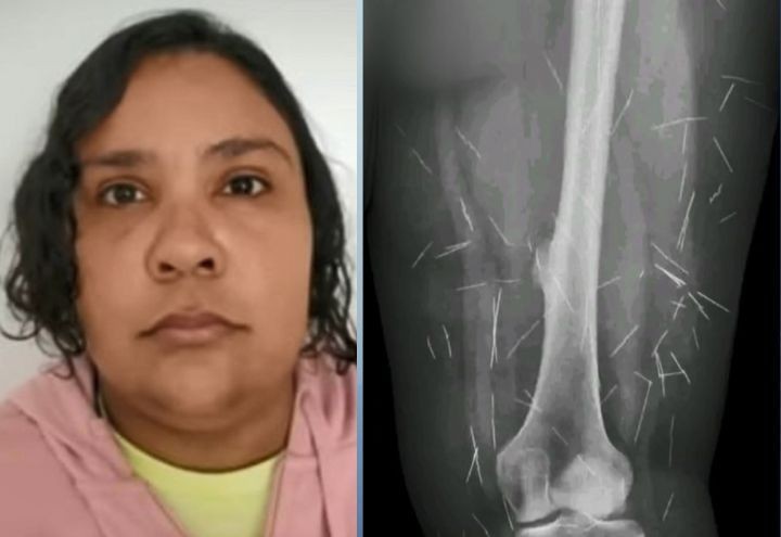 Imagem da noticia De novo, golpista de 42 anos se passa por criança de 11 e é presa