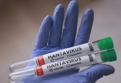 Rio Grande do Sul registra dois casos de hantavirose em 2026; um paciente morreu Rio Grande do Sul registra dois casos de hantavirose em 2026; um paciente morreu