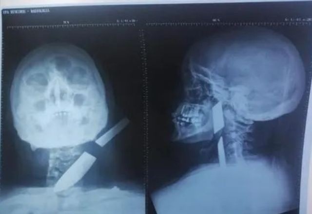 Imagem da noticia Homem é preso por cravar faca no pescoço de ex-mulher em Goiás