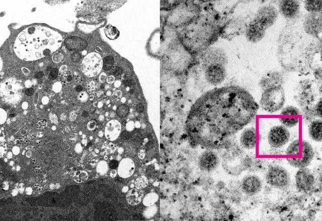 Imagem da noticia Cientistas registram 1ª imagem da variante ômicron