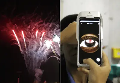 Fogos de artifício no Ano-Novo: oftalmologista alerta para acidentes oculares e cuidados com crianças Fogos de artifício no Ano-Novo: oftalmologista alerta para acidentes oculares e cuidados com crianças