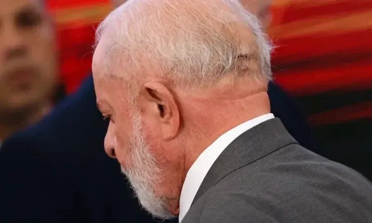 Imagem da noticia Lula passa por embolização da artéria meníngea; entenda procedimento