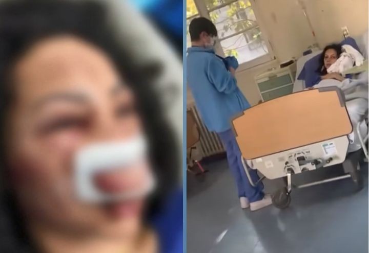 Imagem da noticia Turista brasileira espancada no Chile recebe alta médica